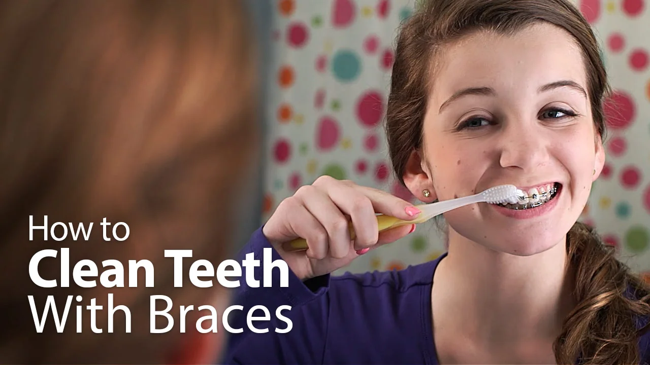 best way to brush teeth with braces