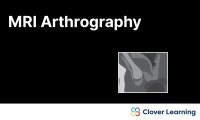 MRI Arthrogram | Video Lesson | Clover Learning